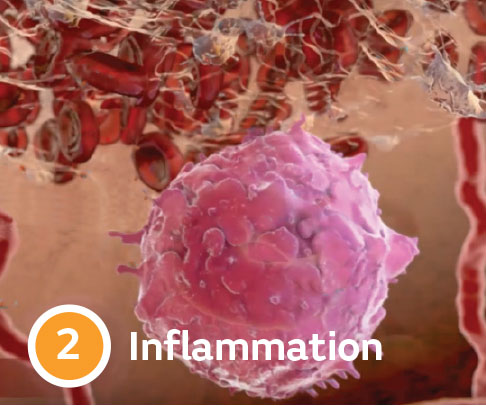 inflamation